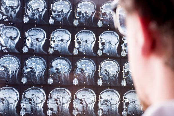 Traumatic Brain Injuries
